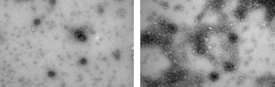 Microscopy images of GancherGoblin and Hexbug